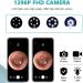 Sadodo Wireless Ear Wax Remover Otoscope | 1296P HD 3.0 MP Endoscope Spoon Pick Tool with LED Lights - White B Style - Buy Online on GoSupps.com