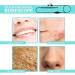 Yannies Ear Wax Remover with 6 LED Lights - HD View Otoscope for Adults, Kids & Pets - Buy Online on GoSupps.com