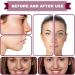 (100% Effective) 4PCS Rosacea Facial Treatment Serum | Fruit Acid Serum for Reduce Redness | Rosacea Care Skin Care | for Face Redness Corrector | Balance Excess Sebum | 30ml - Buy Online on GoSupps.com