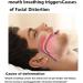 PPGE Anti Snoring Chin Strap - Stop Snoring and Improve Sleep Quality - Black - Buy Online on GoSupps.com