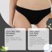 Skin Whitening Cream Bleaching Cream Skin Lightening Cream for Women and Men Dark Spot Remover Corrector Bleach Cream for Neck Armpit Underarm Elbow Inner Thigh and Knees - Buy Online on GoSupps.com