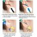 Q-Grips Earwax Remover Kit - Silicone Ear Cleaner Tool with 16 Replacement Tips - Safe, Reusable, and Pain-Free Spiral Q Twist Design for Adults and Kids - Buy Online on GoSupps.com