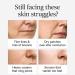 2PCS Collagen Anti Wrinkle Serum Fast Absorbing Non Sticky Moisturizing Strengthen Skin Barrier Skin Tightening 30ml - Buy Online on GoSupps.com