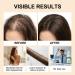 S rum de croissance des cheveux au romarin - Essence pour paissir le cuir chevelu - Soin rafra chissant et non gras du cuir chevelu - Renforce les racines - Soin des cheveux - Soin des cheveux 8 pi ces. - Buy Online on GoSupps.com