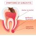 Dentifrice CAREDO pour la gingivite soin r parateur des gencives traitement des gencives saignantes et gonfl es traitement des gencives sensibles traitement de la gingivite pour adultes 100 g - Buy Online on GoSupps.com