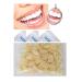 Cosmetic Dental Componeer Thin Whitening Resin Veneer Upper Anterior Teeth 50-Pcs (A2 shade)