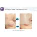 Buy Acne Seboderm Solution - Anti Sebum Treatment for Blemish-Prone Skin | Pore Shrinking Care Worldwide Shipping - Buy Online on GoSupps.com