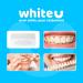 WhiteU Teeth Whitening Strips - 14 Peroxide-Free Enamel-Safe Strips for Sensitive Teeth - Advanced Professional Whitening & Tartar Control - Mint Flavor - Buy Online on GoSupps.com