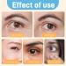 S Rums Anti-Rides Lut Ine Oil 6pcs 8ml Lutein Eye Essence Oil Huile Essentielle Anti-Rides Avec Vc Lut Ine S Rum pour Les Yeux La Lutein Luteine Huile Essentielle de Lut Ine Vc - Buy Online on GoSupps.com