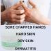 Marble Hill HandSalve Hand Cream - Nourishing Moisturizer for All Skin Types - International Shipping Available - Buy Online on GoSupps.com
