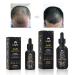ELEVATE Hair Growth Oil - Biotin & Minoxidil Treatment for Stronger, Thicker Hair - 1oz - Buy Online on GoSupps.com