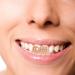 Holibanna Teeth for Men Women Fake Teeth Decoration Halloween Party Punk Hip Hop Teeth Mouth Tooth Cap Jewelry Mouth Fangs - Buy Online on GoSupps.com