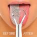 Stainless Steel Tongue Scraper for Adults - Portable Tongue Cleaner Reduces Bad Breath & Freshens Breath - Buy Online on GoSupps.com