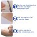 Professional Silicone Scar Removal Sheets - Breathable & Waterproof - 4 Reusable Gel Strips for Lightening Scars - Skin Color, Invisible Tape (7.5*4cm) - Buy Online on GoSupps.com
