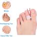 Toe Separator for Hallux Valgus & Bunion Correction - Clear Gel Toe Separators for Crooked & Hammer Toes - 1 Pair - Buy Online on GoSupps.com