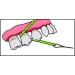 I Dontix Brace X-Floss Green - Easy-to-Use Dental Floss for Efficient Cleaning - Buy Online on GoSupps.com