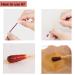 UBae 100pcs Disposable Medical Iodine Swab for Wound Care & Sterilization - Buy Online on GoSupps.com