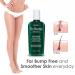 GiGi No Bump Skin Smoothing Topical Solution - 8 fl oz (Pack of 1) | Post-Shave, Waxing, or Laser Hair Removal Treatment - Buy Online on GoSupps.com
