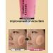 SKINRxLAB Made Cera Cream 50ml - Acne & Redness Relief Moisturizer with Ceramide & Madecassoside | Sebum Control, Skin Barrier Repair | Anti-Aging, Pore Minimizing Face Cream - Buy Online on GoSupps.com