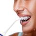 Water Flosser - Cordless Rechargeable Oral Irrigator for Travel & Home | Effective Teeth Cleaner - Buy Online on GoSupps.com