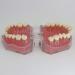 Uigjiog 28 Removable Teeth Dental Implant Model - Translucent Standard Design for Research & Lessons - Buy Online on GoSupps.com