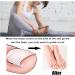Toenail Corrector Patch Ingrown Nail Corrector Ingrown Nail Treatment Ingrown Nail Corrector Stickers Toenail Correction Toenail Patch - Buy Online on GoSupps.com