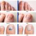 Extra Strength Nail Fungus Treatment - Restoring Healthy Nails 1 Fl Oz (Pack of 1) - Buy Online on GoSupps.com