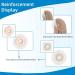 Ostomy Supplies Skin Barrier Strips | Colostomy Bag Skin Extender Strips (20 pcs) | Waterproof Hydrocolloid Half Rings - Buy Online on GoSupps.com