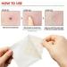Connoworld 24 Patches Beauty Acne Patch Set - Pimple Treatment and Blemish Remover for Clear Skin - Buy Online on GoSupps.com