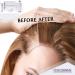 Tricomax Scalp Therapy - Hair Regrowth Stimulant & Thickener with Vitamin E - Reduce Inflammation - 118 ml/4 oz - International Shipping Available - Buy Online on GoSupps.com