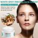 Cr me pour le visage Melasma Taches de rousseur Cr me r novatrice pour la peau fonc e Cr me cosm tique pour le visage peau noire Yunnan Japanese Melasma Cream For All Skin Types (1pcs) - Buy Online on GoSupps.com