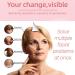 Double Chin Strap - V Line Lifting Mask for Women Reusable Jaw Shaper | Slimming Face Contour for Sleep - Buy Online on GoSupps.com