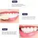 Body Accel Whitening Toothpaste 100g - Teeth Whitening Stain Removal & Fresh Breath - Buy Online on GoSupps.com
