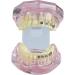 Dental Orthodontic Demonstration Model Dental Teeth Orthodontic Retainer Treatment Model with Metal Self-ligating Brackets Explaining Model - Buy Online on GoSupps.com