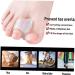 Pinicecore 2ST Toe Silicone Bunion Protection | Orthopedic Toe Spreader & Separator for Foot Care - Buy Online on GoSupps.com