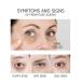 VENZEN Pure 24K Gold Eye Cream - Luxury Nourishment and Hydration - 30g - Buy Online on GoSupps.com