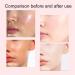 (100% Effective) 5PCS Essence Glow Serum | Essence Watermelon Glow Serum | Essence Good Stuff Glow Serum Primer | Glow Boosting Serum for Face | Glow Watermelon Moisturizer Suitable for Moisturizing All Skin Types | 30ml/1.01fl.oz - Buy Online on GoSupps.com