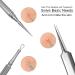 SGNEKOO Professional Facial Milia Removal Tool and Whitehead Extractor Kit - Buy Online on GoSupps.com