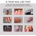 Nail Repair Treatment Gel - Instantly Renew Yellow, Cracked Nails - Buy Online on GoSupps.com