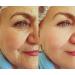 Neuropeptide & Growth Factor Wrinkle Serum - Brightening Antioxidant Collagen Peptides & Hyaluronic Acid for All Skin Types - Reduce Fine Lines & Premature Aging - 1oz - Buy Online on GoSupps.com