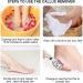 Foot Care Pedicure Callus Shaver Stainless Steel Foot Callus Remover Heel Razor Callus Shaver Sets Include 10 Replacement Slices and 1 Foot File Head Dry Hard Skin Remover for Hand Feet - Buy Online on GoSupps.com