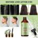 Fengyang Rosemary Oil for Hair Growth | Pure Rosemary Essential Oil for Thicker Hair - Buy Online on GoSupps.com