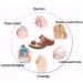 Women s Open Toe Sandals - Summer Hollow Clip Toe Bunion Corrector Wedge Heels & Flip Flops for Big Toe Bone Correction - Orthopedic Travel Footwear - Size 8.5 Red - Buy Online on GoSupps.com