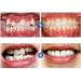 Set of 5 Transparent Mouth Guards for Teeth Grinding - Night Guard for Sleep Support - Buy Online on GoSupps.com