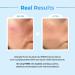 Le Nubele Azulene Cica Hyaluronic PDRN Capsule Standard Ampoule 02 Salmon DNA PDRN 3 000ppm Peptide Collagen Booster Skin Rejuvenation Hydrating Acne Skin Korean Skin Care 30ml/1.01 fl.oz. - Buy Online on GoSupps.com