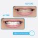 GO SMILE Extreme Duo Professional Teeth Whitening Travel Kit - 14 Whitening Swabs & Enamel Brush Pen in Portable Tin - Stain Remover, No Sensitivity - Buy Online on GoSupps.com