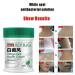 Vitiligo Cream for White Spot Treatment - Natural Care for Skin Pigmentation & Melanocytes - 1.05 Ounce Pack - Buy Online on GoSupps.com