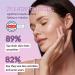 High Strength Retinol Serum - 2 5% Retinol Anti-Ageing Formula with Hyaluronic Acid and Witch Hazel - 30ml - Intensive Face Care against Wrinkles and Age Spots - Buy Online on GoSupps.com