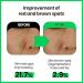Real Barrier Cica Relief Rx Calming Cream 60ml | Redness Relief & Moisturizing Lotion for Sensitive Skin | Fast Hydration | Korean Skincare - Buy Online on GoSupps.com