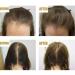 Hair Growth Serum - Anti hair loss promote hair growth PREMIUM FORTIFYING Hair Growth Treatment repair damaged hair hair care essential oil - Buy Online on GoSupps.com